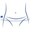 Hips circumference (cH)